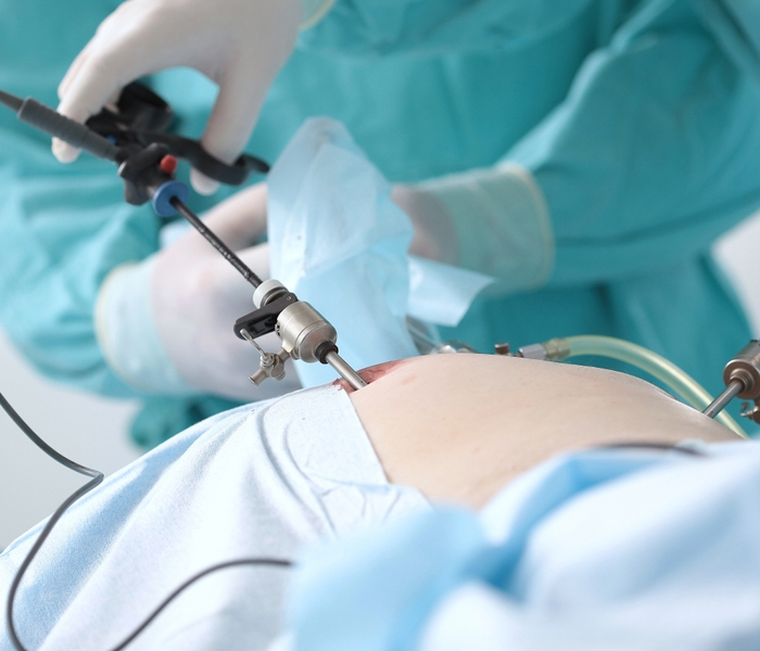 SPM Diagnostics